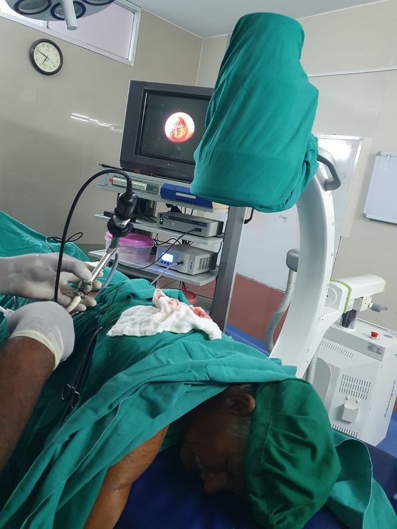  PCNL PROCEDURE